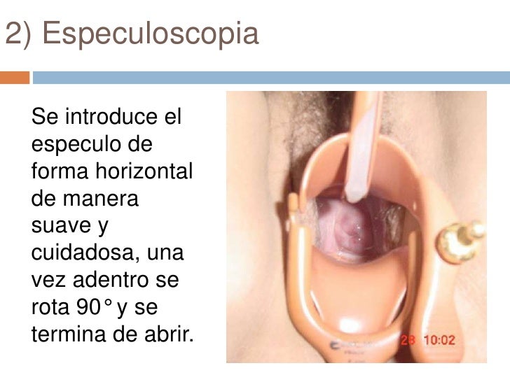 especuloscopia tecnica